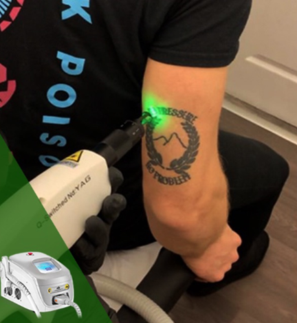 QS laser equipment 2 QSレーザー装置2