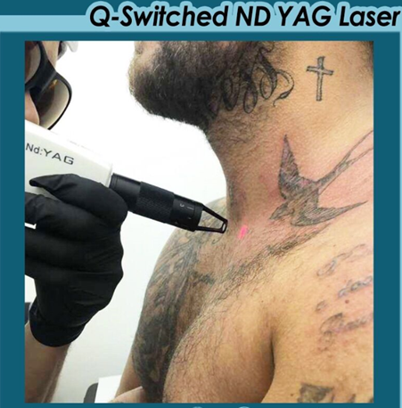 QSレーザー装置1台