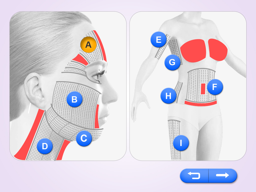 マルチラインHIFU HS-511