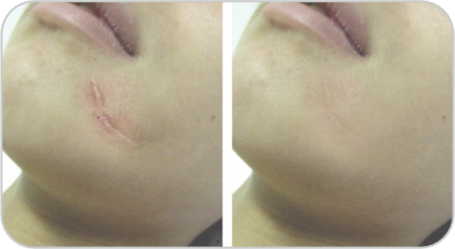 ビフォーアフター2