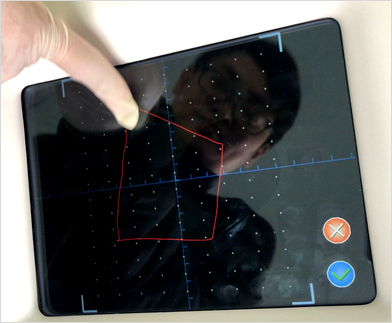C02レーザースクリーン5