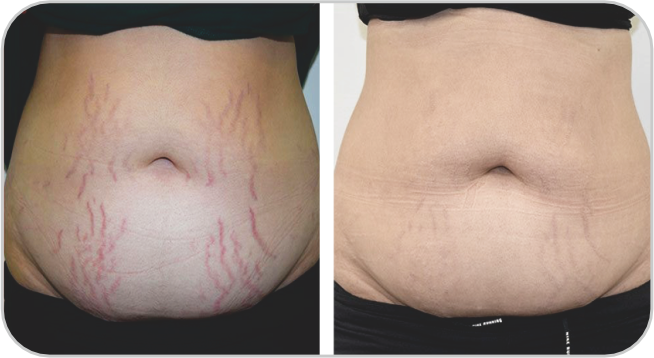 ビフォーアフター3