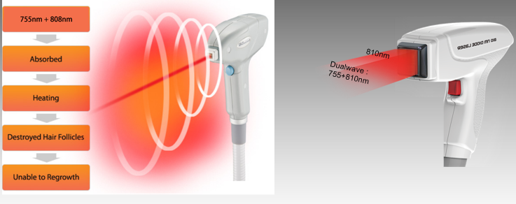 ダイオードレーザー装置