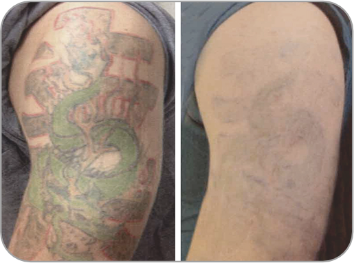 ビフォーアフター1