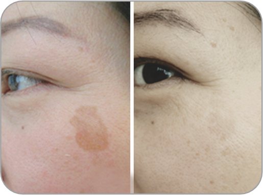 ビフォーアフター2